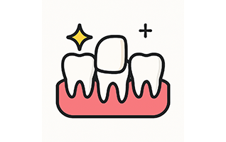 Dental Veneers